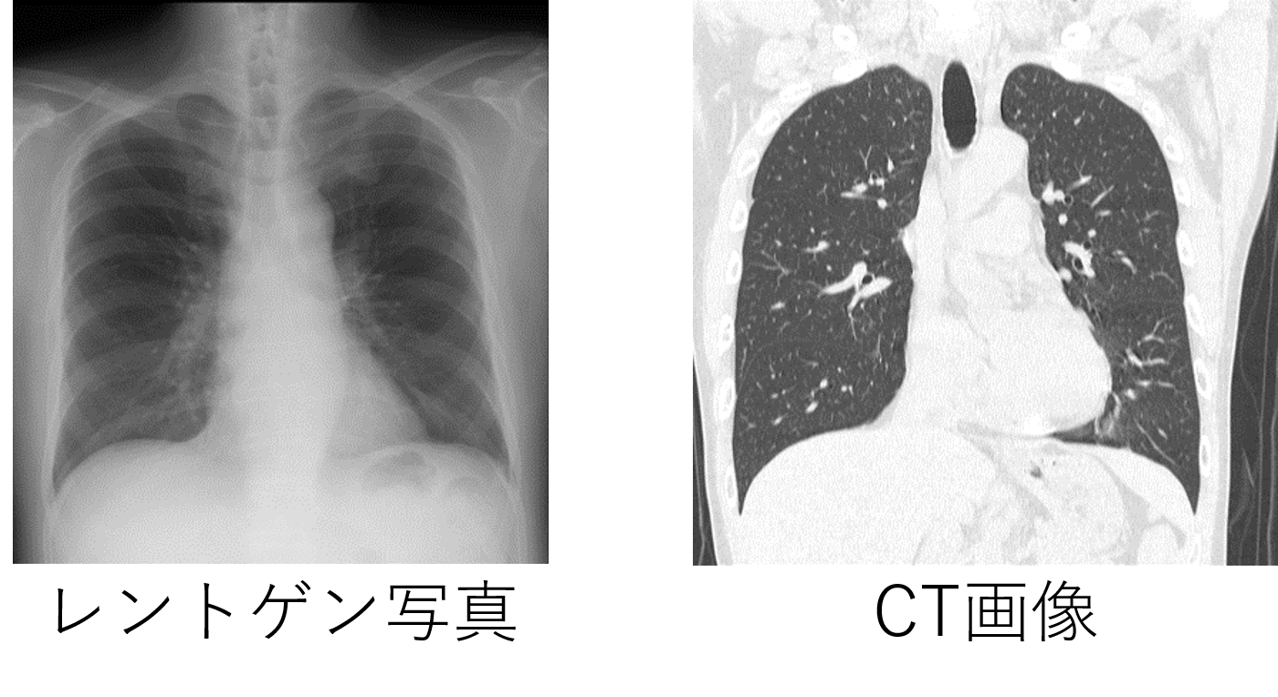 全身ct 肺がんドック 佐藤脳神経外科 豊橋 Mri Ct 美容 頭痛 痛み 脳梗塞 認知症 白玉点滴 プラセンタ